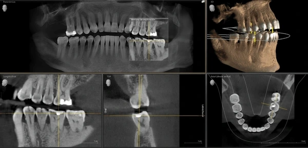 cbct near you