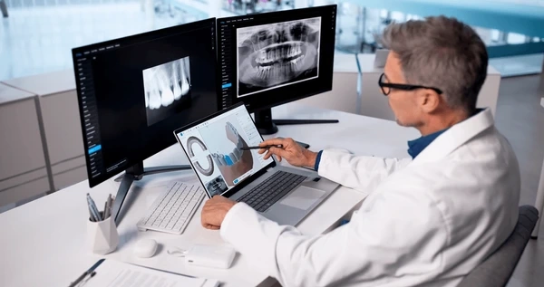 itero scanner in abbotsford, bc