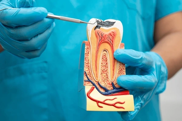 root canal treatment near you